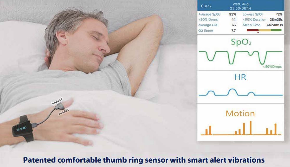 Patented comfortable thumb ring sensor with smart alert vibrations